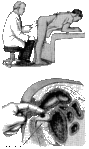 prostata1.gif